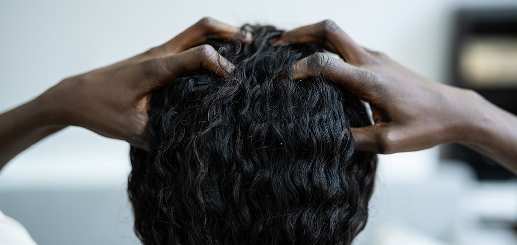 Image of Young Woman Scratching Her Itchy Head